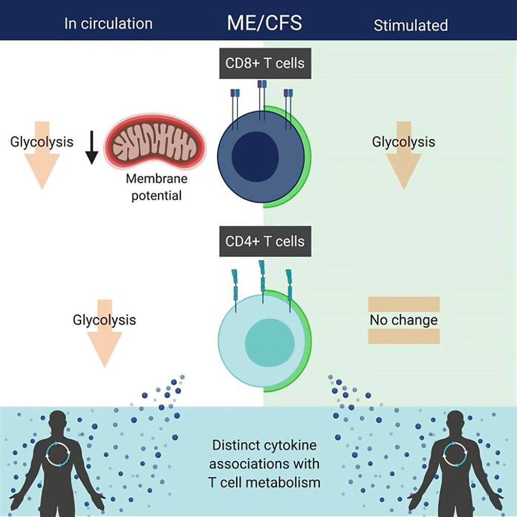 Image: Myalgic encephalomyelitis/chronic fatigue syndrome patients exhibit altered T cell metabolism and cytokine associations (Photo courtesy of Cornell University)