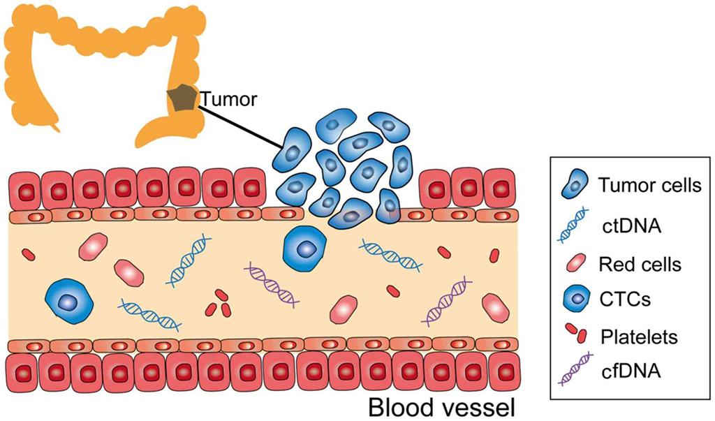 Image: Schematic diagram of, circulating tumor DNA (ctDNA); circulating tumor cell (CTC); cell-free DNA (cfDNA) in the peripheral blood stream of a colon cancer patient (Photo courtesy of Oncology Letters)