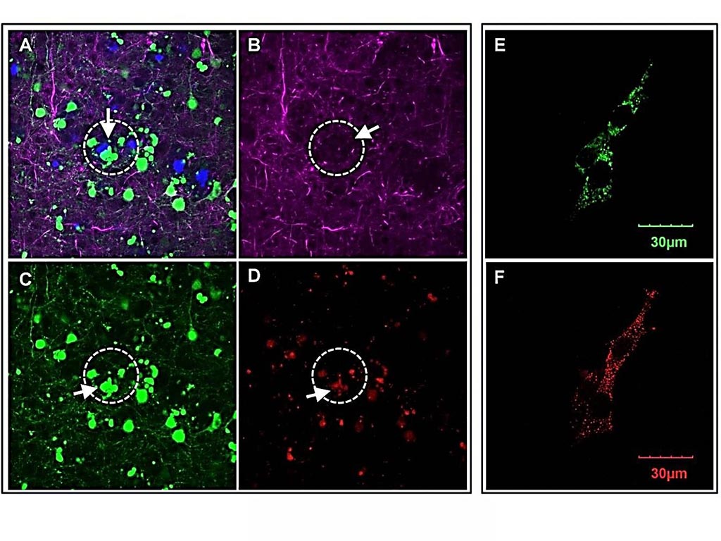Image: In the brain of mice with Alzheimer\'s, areas near amyloid plaques (A) appear with fewer neural networks (B), dying neurons (C) and higher OCIAD1 (D). In cultured neuronal cells, the OCIAD1 proteins (E) appear in the mitochondria (F) (Photo courtesy of Houston Methodist Research Institute).