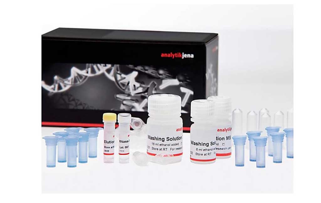 Image: The innuPREP MP Basic Kit A for fast, efficient isolation of DNA and RNA of either viral or bacterial origin (Photo courtesy of Analytik Jena).