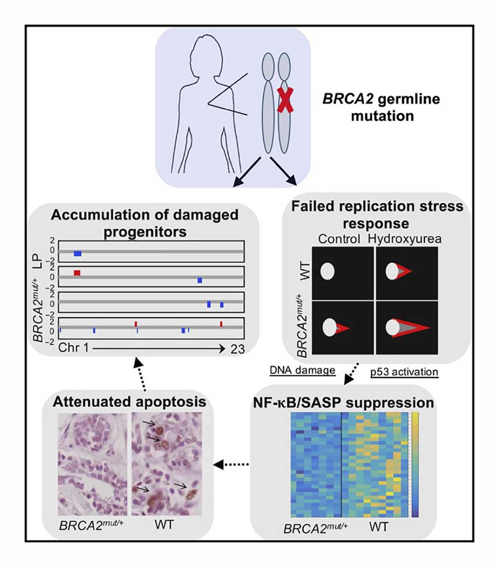 Image: Summary of findings in primary BRCA2mut/+ breast tissues: Epithelial progenitor cells of heterozygous germline BRCA2 carriers exhibit DNA damage, failed replication stress, and damage responses, together with attenuated apoptosis. Loss of heterozygosity (LOH) analyses suggests that these findings may reflect a haploinsufficient phenotype for BRCA2 in vivo (Photo courtesy of Massachusetts General Hospital).