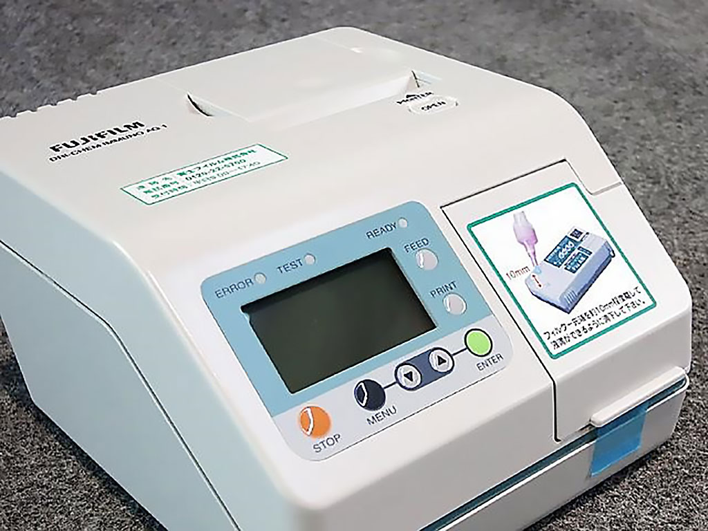 Image: The FUJI DRI-CHEM IMMUNO AG1 analyzer (Photo courtesy of FUJI FILM).