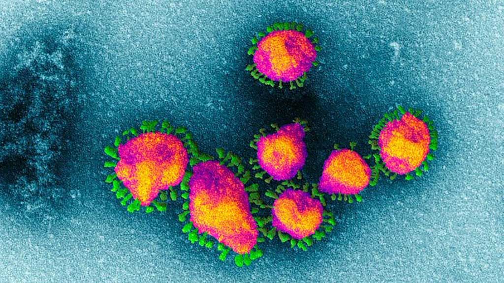 Image: Electron micrograph of Coronaviruses which take their name from their crown-like halo (Photo courtesy of EYE OF SCIENCE/SPL).