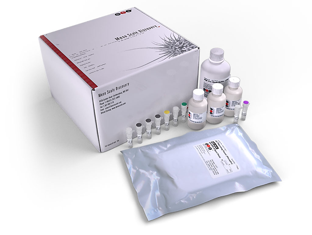 Image: The V-PLEX Proinflammatory Panel 1 Human Kit measures 10 cytokines that are important in inflammation response and immune system regulation as well as numerous other biological processes (Photo courtesy of Meso Scale Discovery).