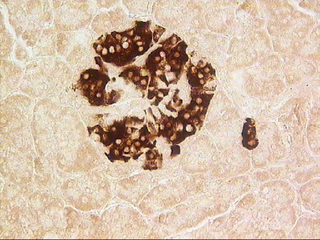 Image: Photomicrograph of a pancreatic islet, showing insulin-producing beta cells (Photo courtesy of Wikimedia Commons)