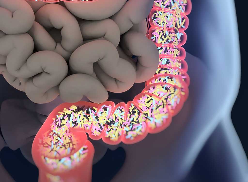 Image: The composition of patients` microbiomes can predict their clinical outcomes when undergoing stem cell transplants (Photo courtesy of European Leukemia Net).