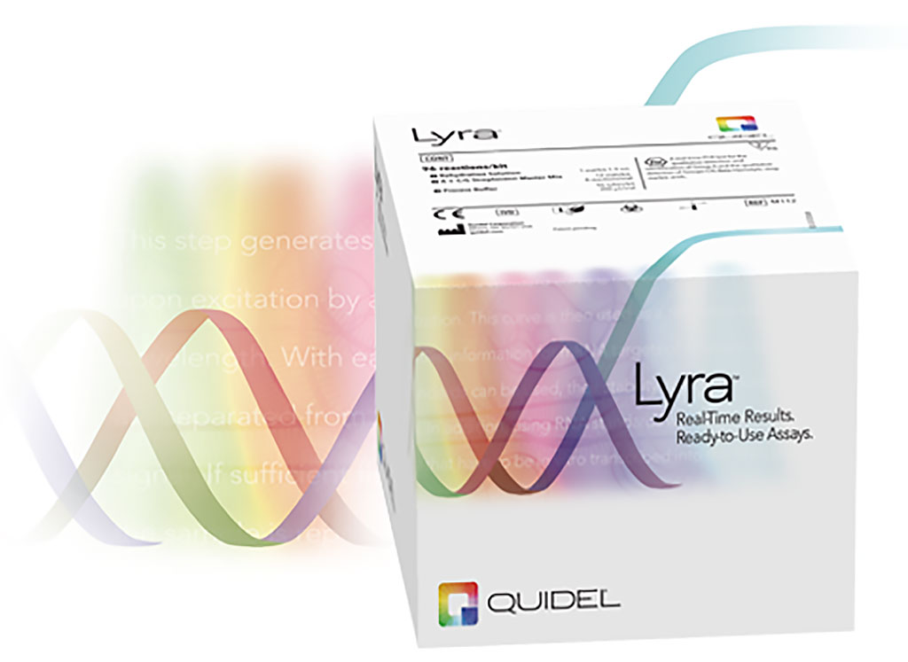 Image: The Lyra SARS-CoV-2 Assay (Photo courtesy of Quidel Corporation)