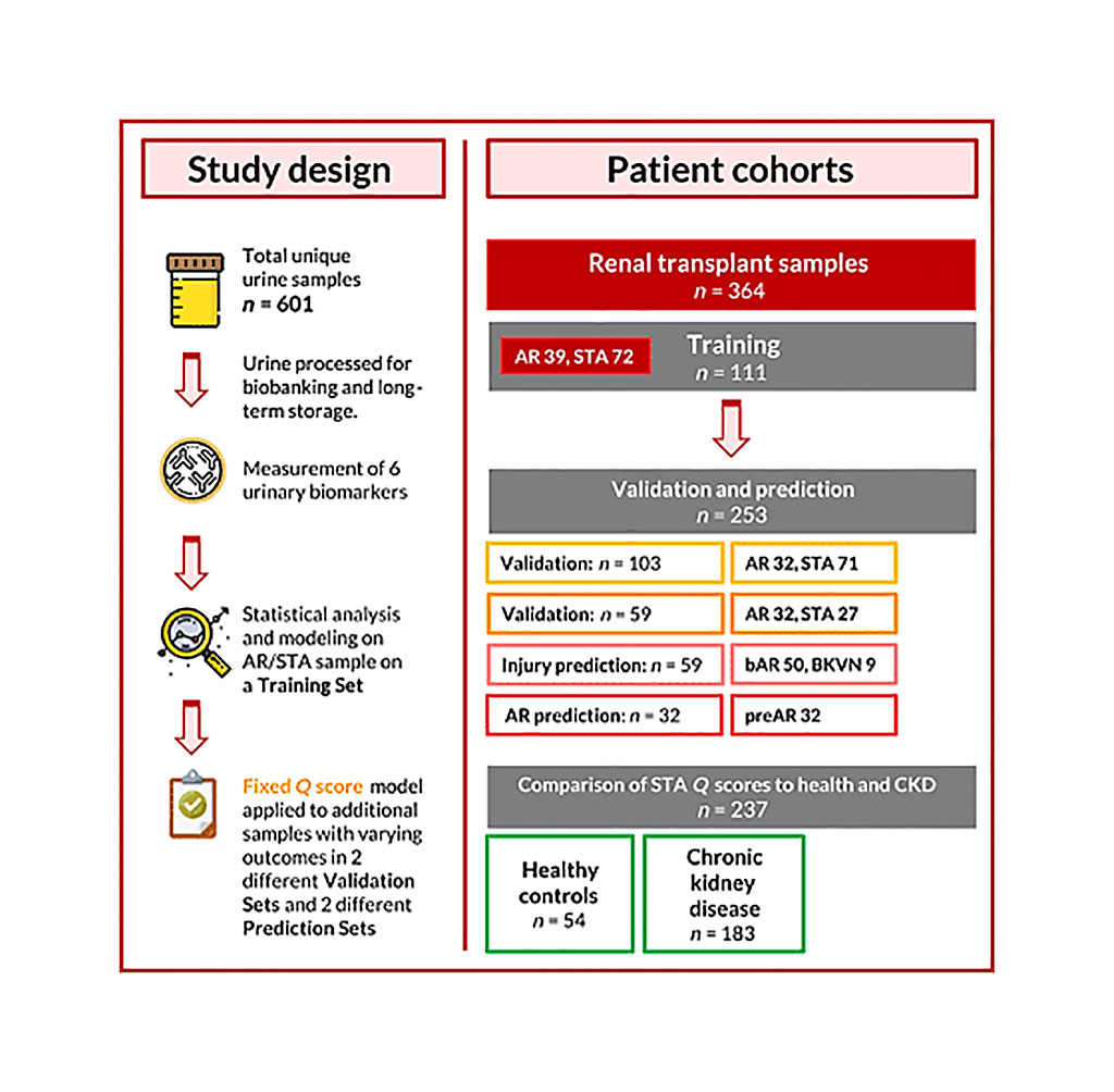 Image: Schematic diagram of a urine score for noninvasive accurate diagnosis and prediction of kidney transplant rejection study (Photo courtesy of the University of California, San Francisco).