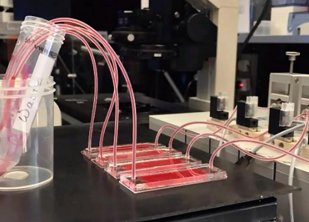 Image: A new fluid analyzing platform allows for the isolation of circulating tumor cells (CTCs), which are formed during metastasis (Photo courtesy of NYU Abu Dhabi)
