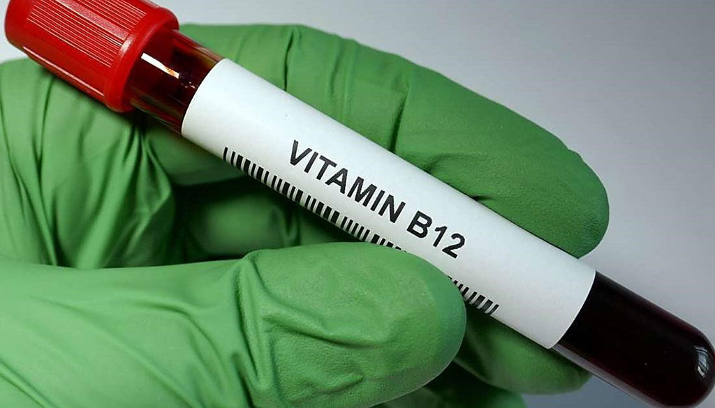 Image: Higher vitamin B12 level at Parkinson`s disease diagnosis is associated with lower risk of future dementia (Photo courtesy of Jayne Leonard)