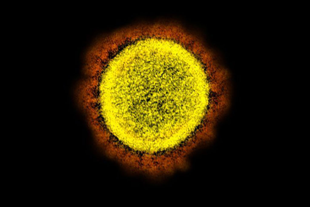 Image: Transmission electron micrograph of the SARS-CoV-2 virus (Photo courtesy of NIAID)