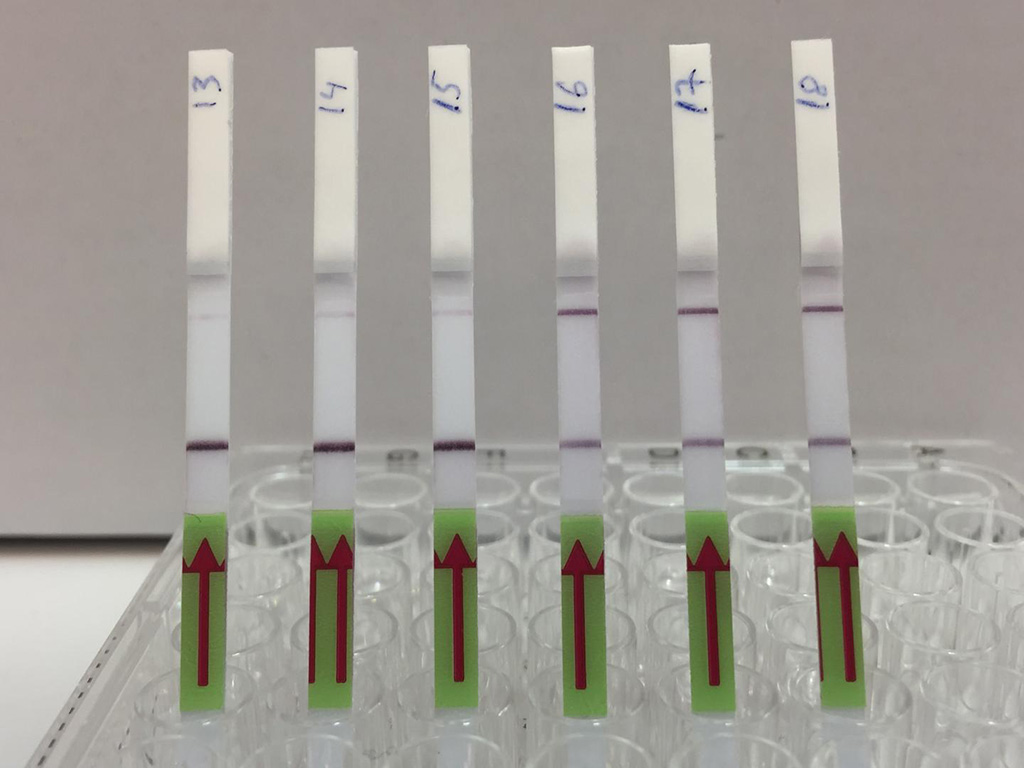 Image: The lateral flow strips show three patient samples that are negative for BK virus (13,14,15) and three patient samples that are positive (16,17,18). Presence of the upper band indicates a positive test result (Photo courtesy of Dr. Michael Kaminski, Max Delbrück Center for Molecular Medicine)