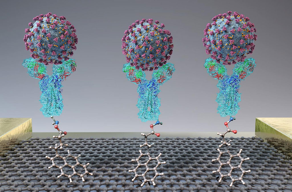 Image: A new test quickly detects SARS-CoV-2 (spheres) through binding to antibodies (Y-shapes) on a field-effect transistor (Photo courtesy of adapted from ACS Nano 2020, DOI: 10.1021/acsnano.0c02823).