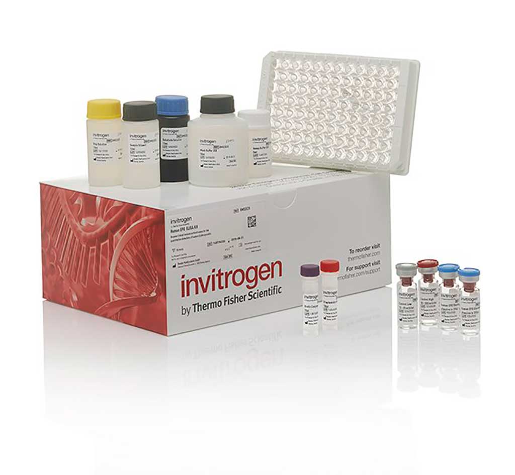 Image: The Clusterin Human ELISA kit (Photo courtesy of Invitrogen).