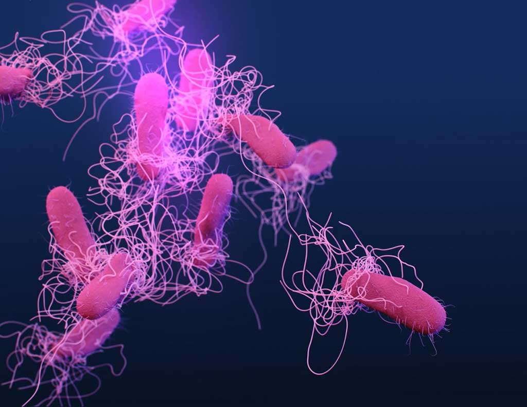 Image: Salmonella are gram-negative, rod-shaped, facultative anaerobic bacteria. Newly developed sensitive and specific assays are able to detect different serotypes of Salmonella, paving the way for rapid serotyping directly from specimens (Photo courtesy of Public Health Image Library, [U.S.] Centers for Disease Control and Prevention)
