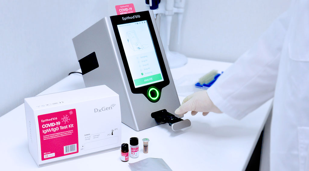 Image: The newly-developed Epithod 616 analyzer and COVID-19 IgM/IgG test kit from DxGen (Photo courtesy of DxGen Corp.)