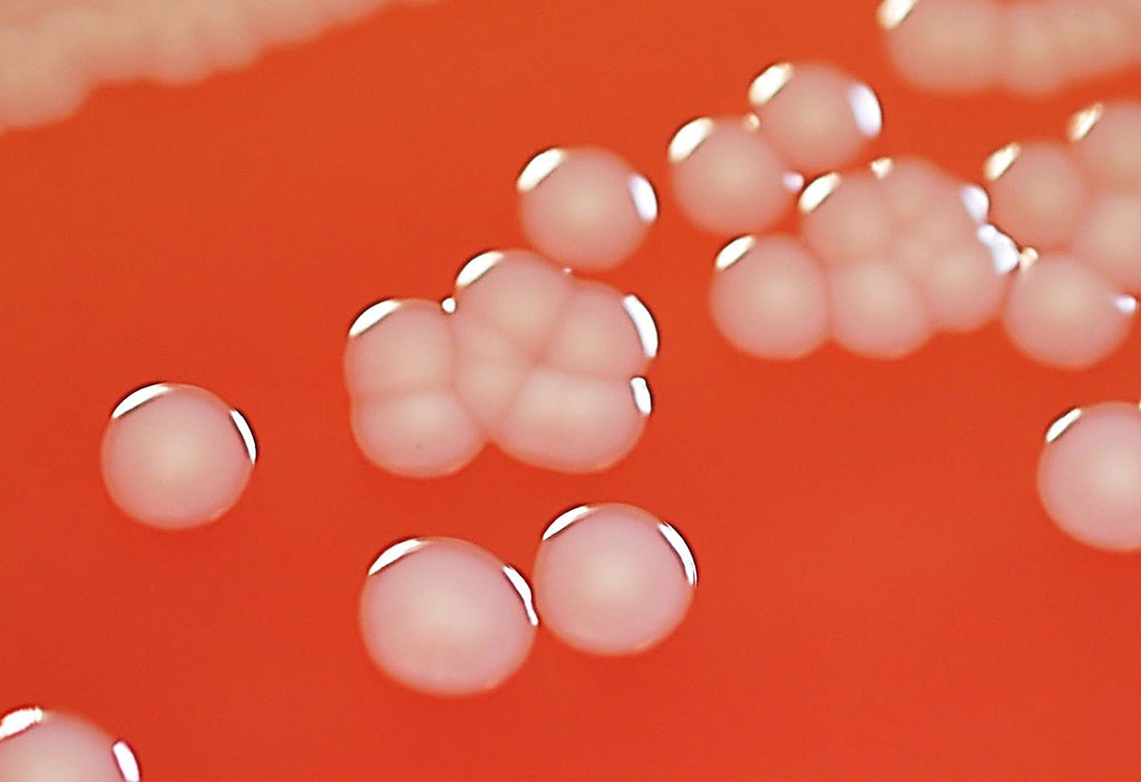 Image: Stenotrophomonas maltophilia colonies on sheep blood agar. Cultivation 48 hours in an aerobic atmosphere, 37 °C (Photo courtesy of microbiologyinpictures).