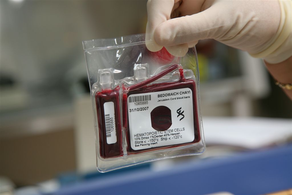 Image: A unit of cord blood that can be used for stem cell transplants (Photo courtesy of Catholic University of Valencia).