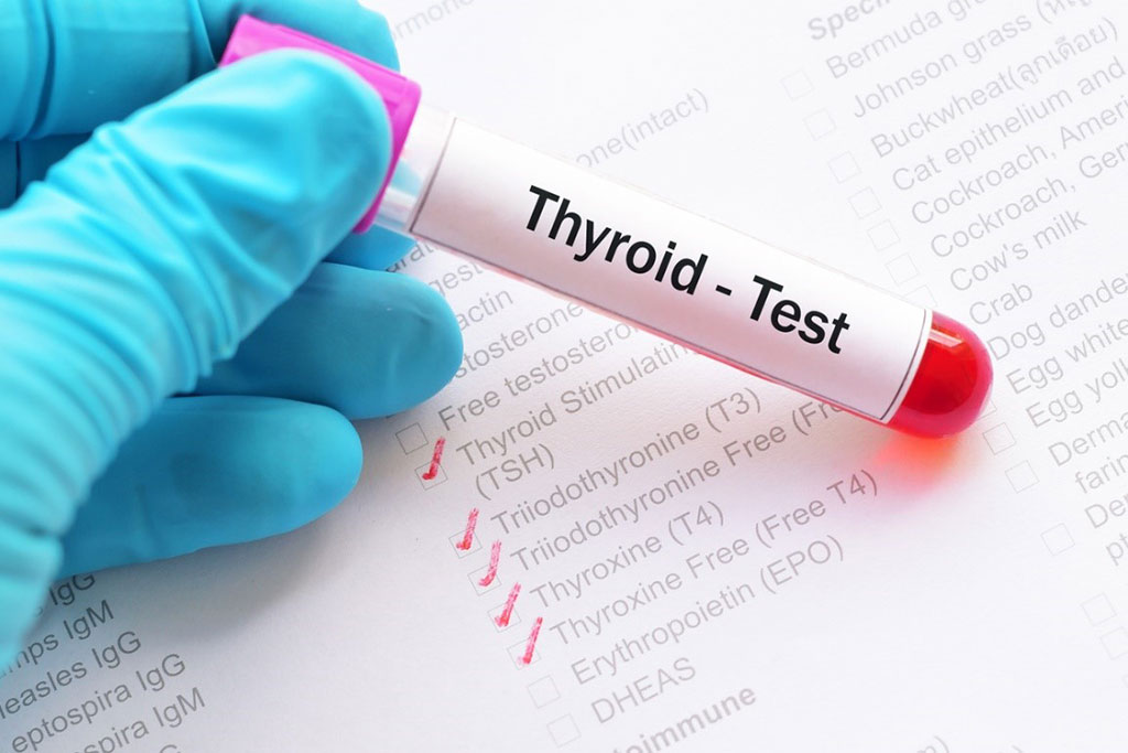 Image: Thyroid-stimulating hormone variations in pregnancy may prompt erroneous subclinical thyroid disease diagnosis (Photo courtesy of HealthEngine).