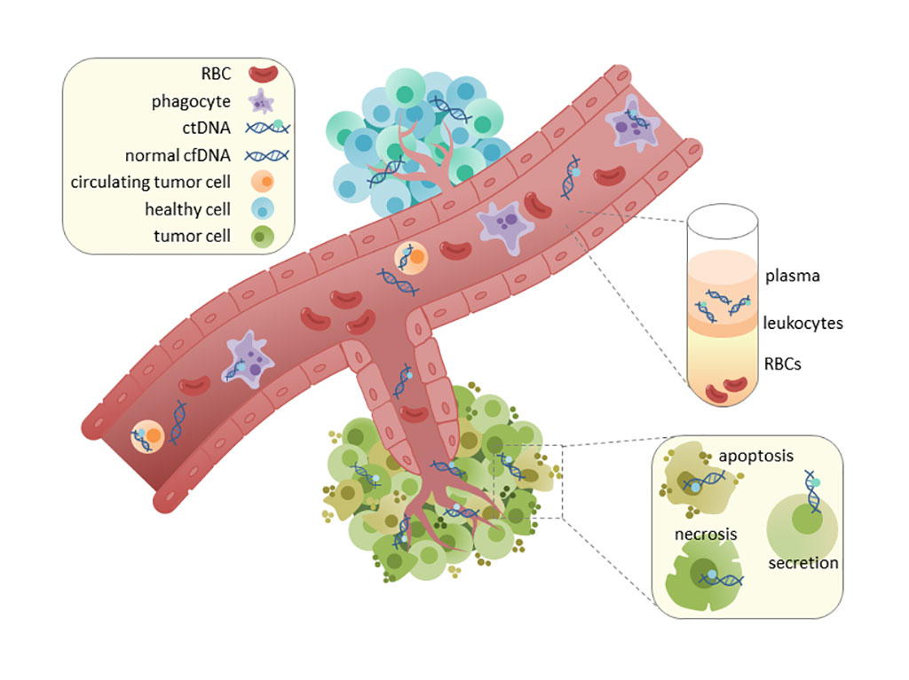 Image: Circulating tumor DNA (ctDNA) is found in serum and plasma fractions from blood. The mechanism of ctDNA release is unknown, though apoptosis, necrosis, and active secretion from tumor cells have been hypothesized. Once ctDNA is isolated, it can be sequenced for mutational analysis (Photo courtesy of Wikimedia Commons)