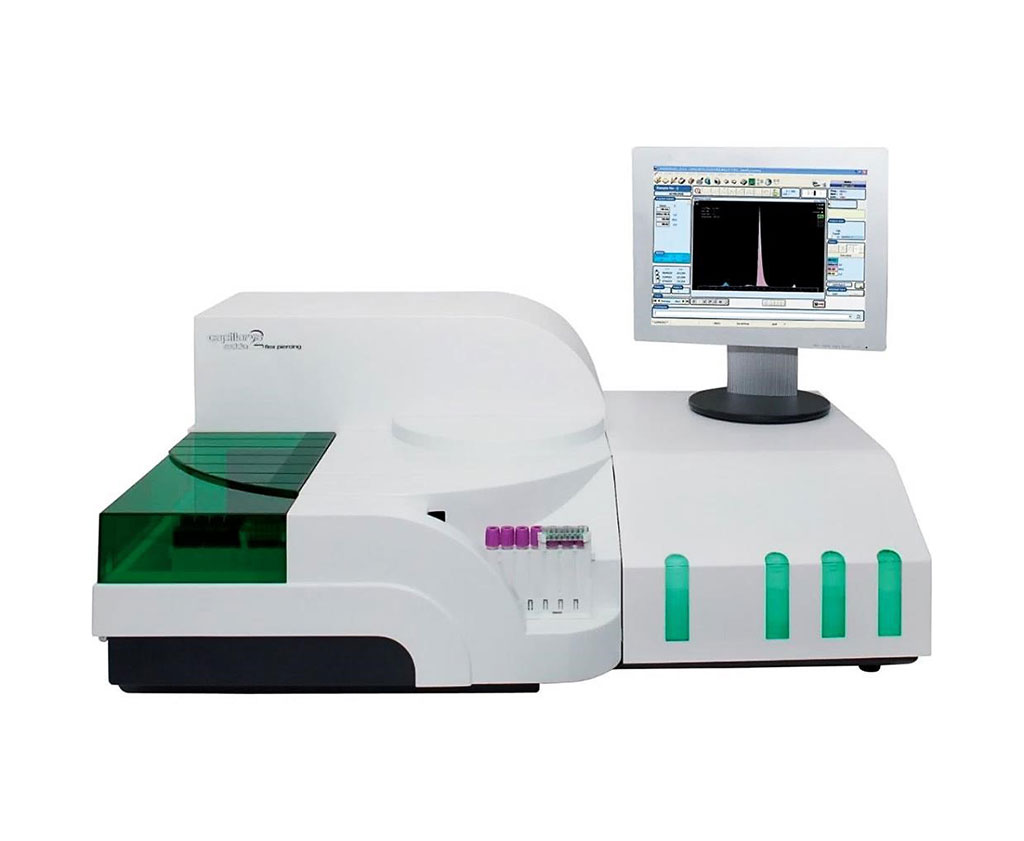 Image: CAPILLARYS 2 FLEX PIERCING is an instrument utilizing capillary electrophoresis developed to be versatile while providing a clear-cut and precise protein separation with high throughput (Photo courtesy of Sebia).
