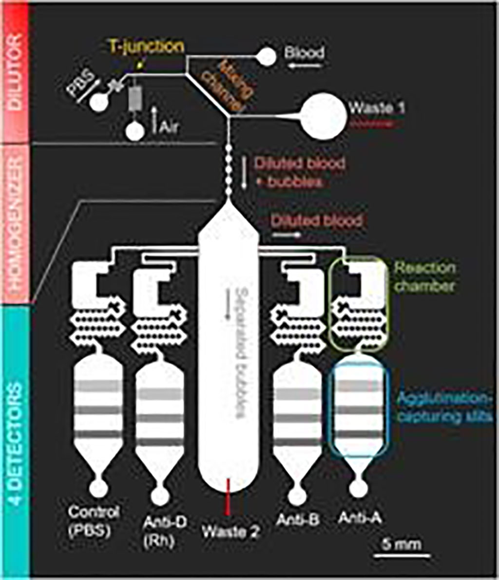 Image: Schematic diagram of the fully-automatic blood-typing chip exploiting bubbles for quick dilution and detection (Photo courtesy of Tokyo University of Science).