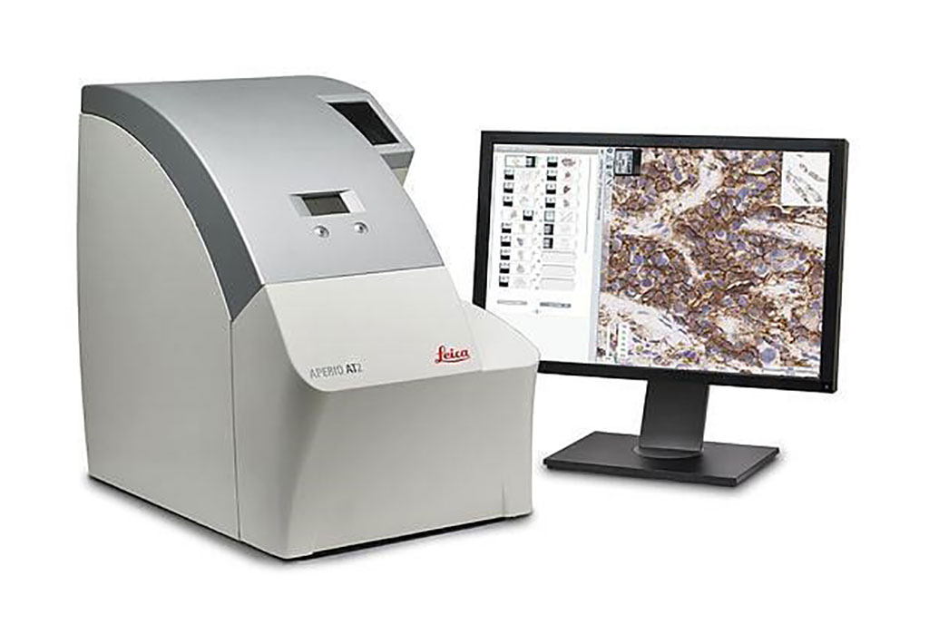 Image: The Aperio AT2 is the ideal digital pathology slide scanner for high-throughput clinical laboratories, delivering precise eSlides with low rescan rate (Photo courtesy of Leica Biosystems).
