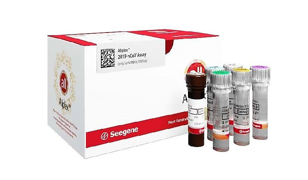 Image: Allplex 2019-nCoV Assay (Photo courtesy of Seegene, Inc.)