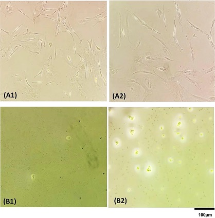 Cells in wells of a 96 well-plate before (A) and after (B) lysis cell by Direct PCR (B1) and Chelex100 (B2) (Photo courtesy of University Hospital Hamburg‐Eppendorf).