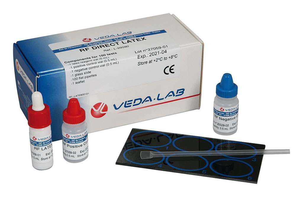 Image: The RF direct latex tests for the detection of rheumatoid factor (RF) in serum (Photo courtesy of VedaLab).