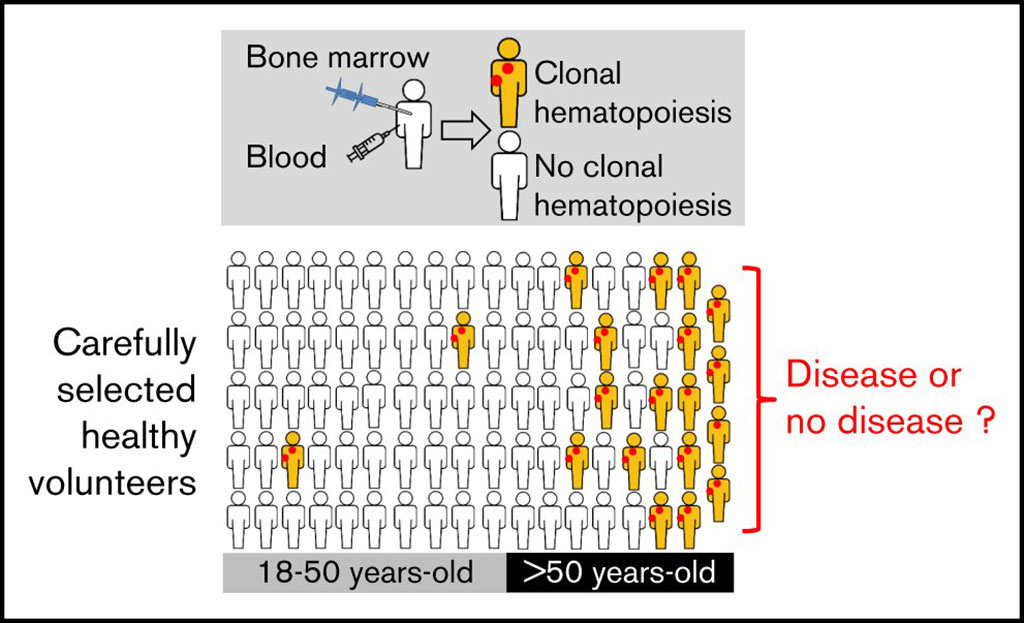 Image: Higher prevalence of clonal hematopoiesis found in the blood and bone marrow of older healthy volunteers (Photo courtesy of Sorbonne University).
