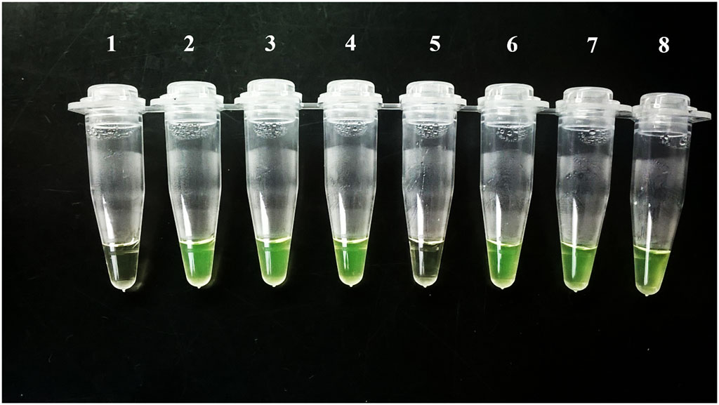 Image: Visualization of Loopamp Trypanosoma cruzi results by the naked eye, Tubes 1 (Negative control) and 5 were negative, but #5 was positive on qPCR with a very low DNA load (Photo courtesy of Laboratorio de Biología Molecular de la Enfermedad de Chagas).