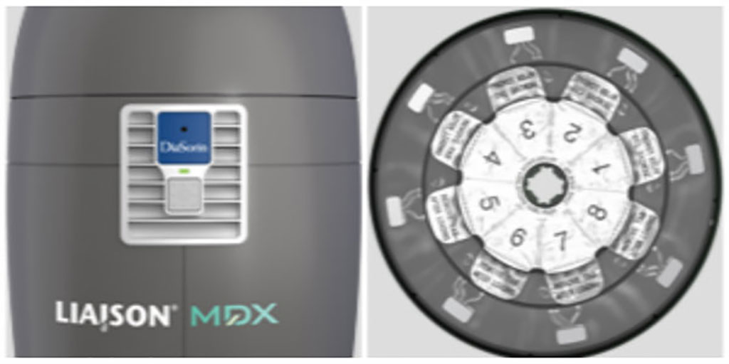 Image: LIAISON® MDX (Photo courtesy of DiaSorin Molecular LLC)