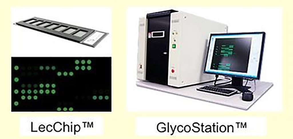 Image: The LecChip and GlycoStation were used to identify subtle surface ABO blood group glycoprotein density variations (Photo courtesy of Glycotechnica).
