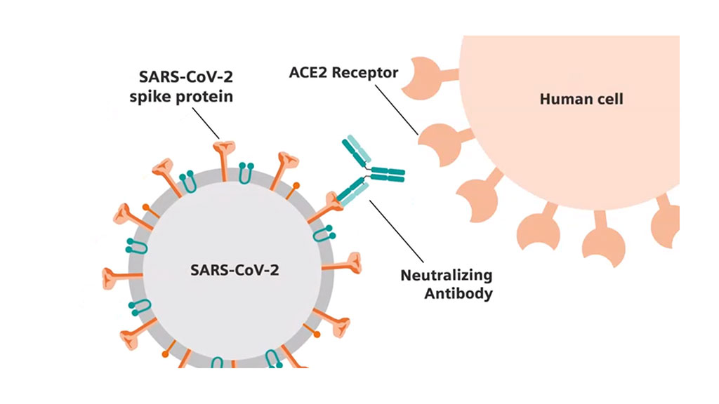 Image: Siemens’ collaboration with the CDC and the JRC will develop a novel process for standardizing SARS-CoV-2 assays by anchoring each protein to a neutralization antibody titer - a level of antibody present to block virus from entering cells in laboratory experiments (Photo courtesy of Siemens Healthineers)