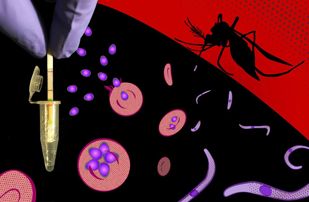 Image: A field-applicable, ultrasensitive diagnostic assay specifically detects DNA and RNA sequences from all Plasmodium species in symptomatic and asymptomatic malaria, and delivers its results fast in simple reporter devices (Photo courtesy of Peter Nguyen, Harvard University)
