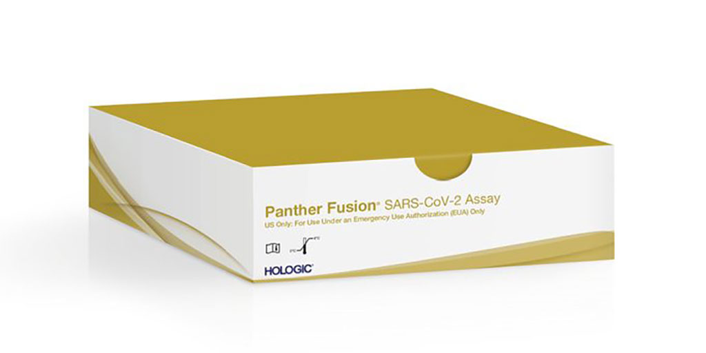 Image: Panther Fusion SARS-CoV-2 assay (Photo courtesy of Hologic, Inc.)