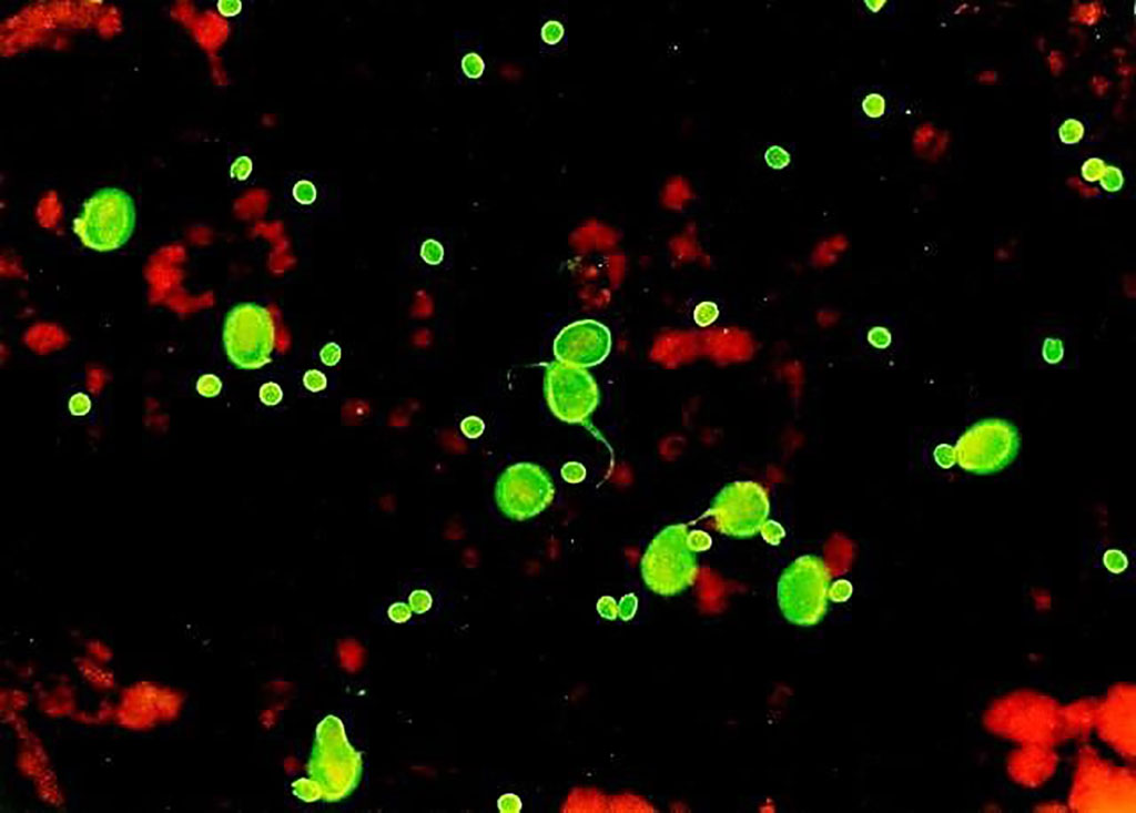 Image: Cryptosporidium oocysts and the larger Giardia cysts stained by Crypto/Giardia IFA kit (Photo courtesy of Cellabs).