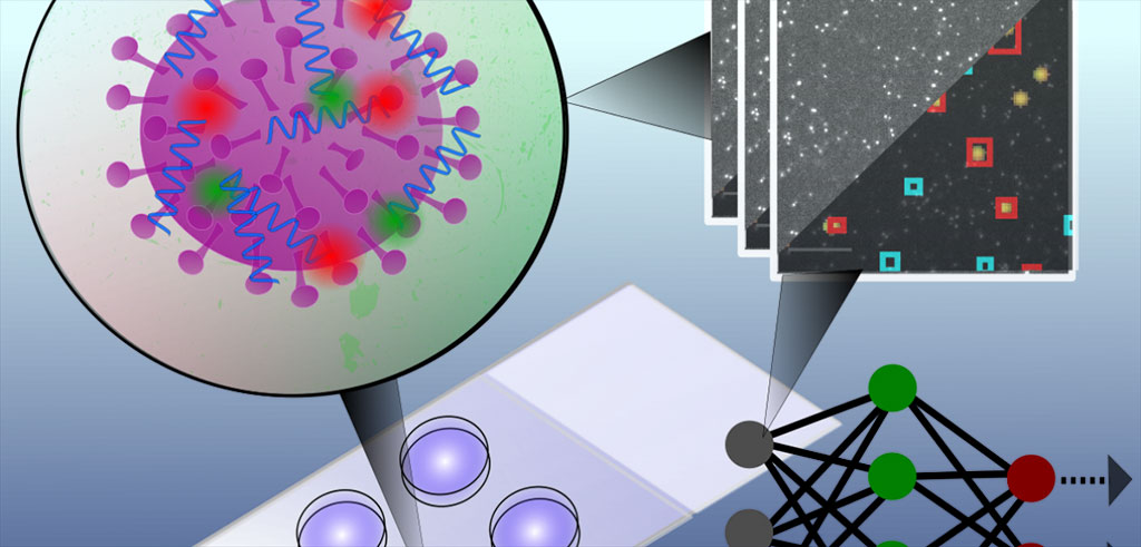 Image: The test uses a convolutional neural network to classify microscopy images of single intact particles of different viruses (Photo courtesy of University of Oxford)