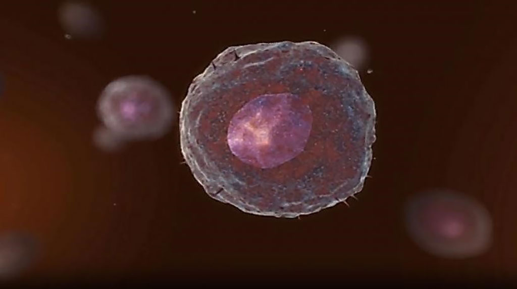 Image: Circulating tumor cells (CTCs) are cancer cells that are released and disseminated into the bloodstream and lymphatic system. CTC cultures were successfully propagated from breast epithelial cells (Photo courtesy of Menarini Silicon Biosystems).