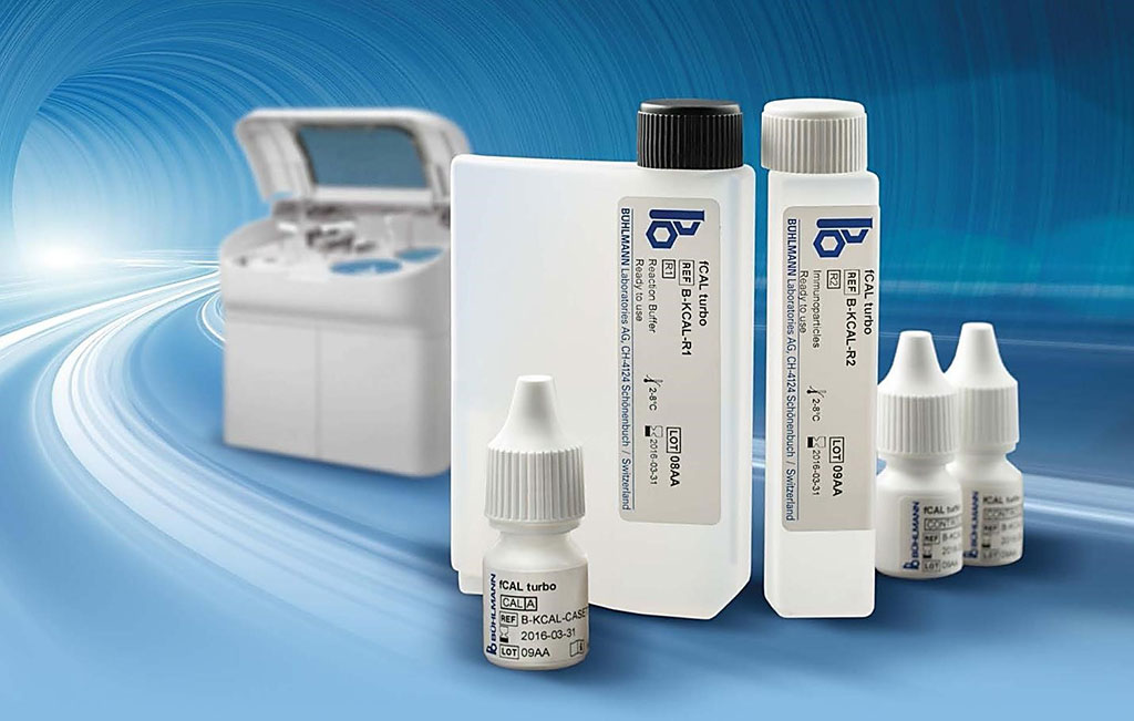 Image: The Buhlmann fCal Turbo turbidimetric immunoassay measures fecal calprotectin in stool specimens (Photo courtesy of Buhlmann Diagnostics).