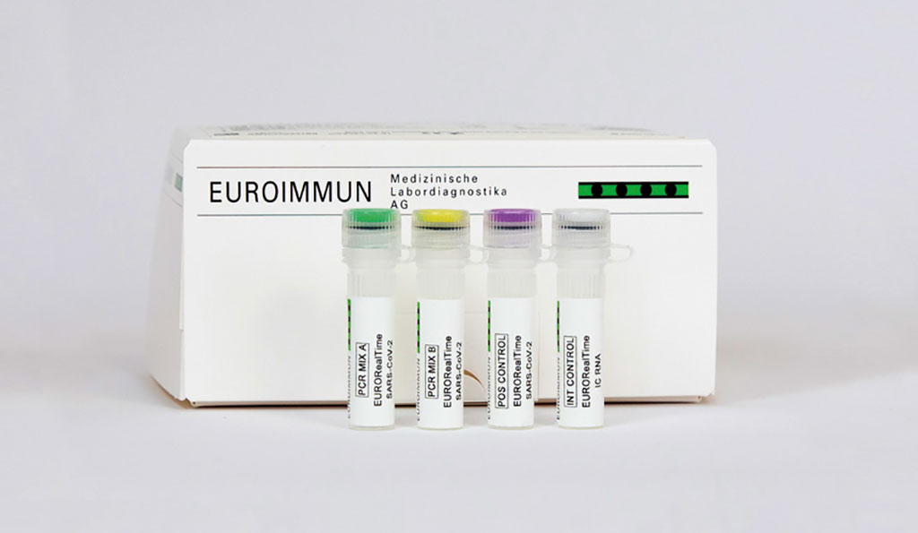 Image: EURORealTime SARS-CoV-2/Influenza A/B (Photo courtesy of EUROIMMUN)