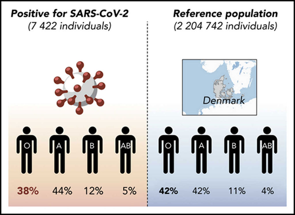 Image: Reduced prevalence of SARS-CoV-2 infection in blood group O individuals reported in Denmark (Photo courtesy of Odense University Hospital).