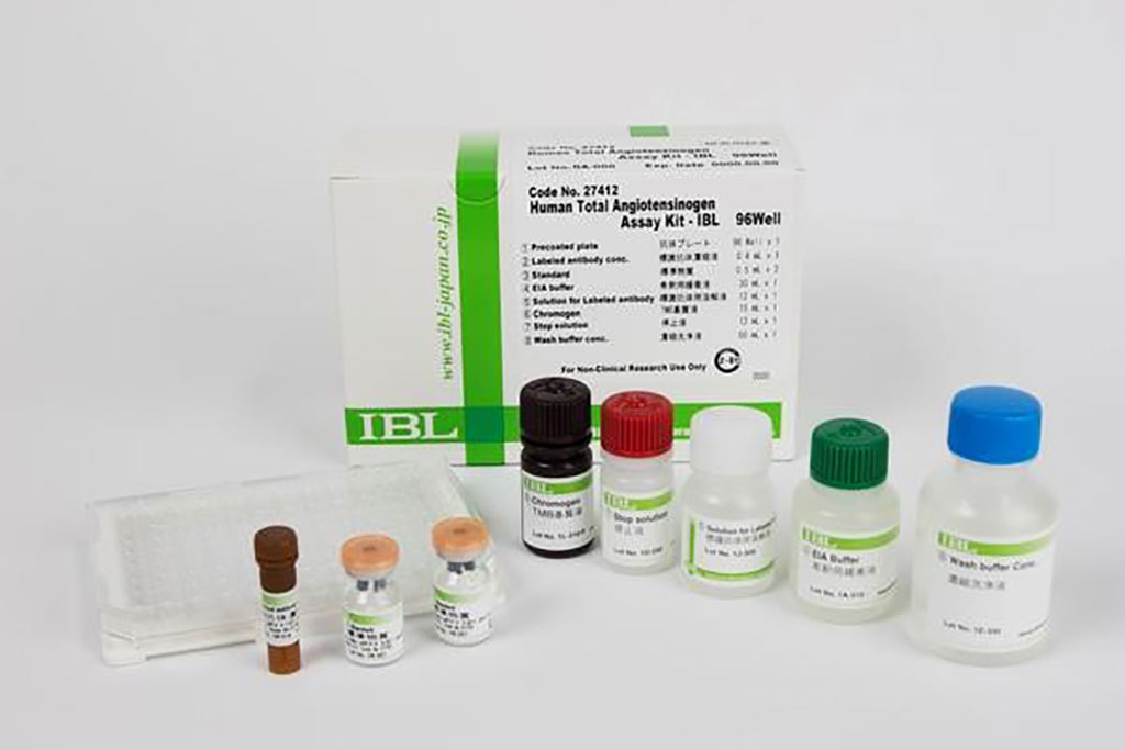 Image: Human Total Angiopoietin ELISA assay (Photo courtesy of Immuno-biological laboratories Co).