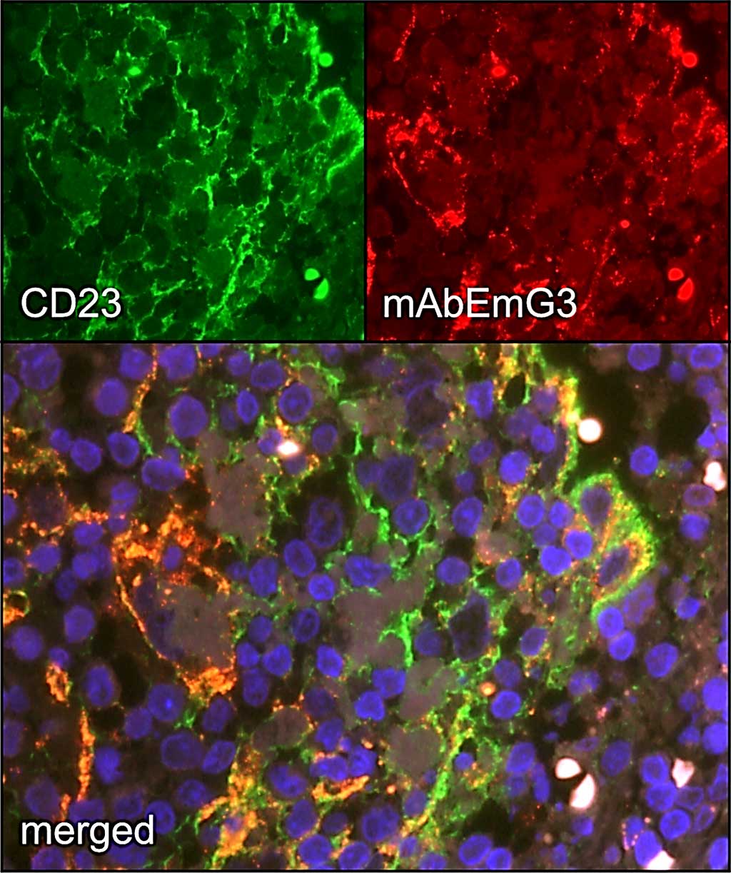 Image: Fluorescence staining of lymph node containing spegs from patients with cystic echinococcosis (Photo courtesy of University of Ulm).