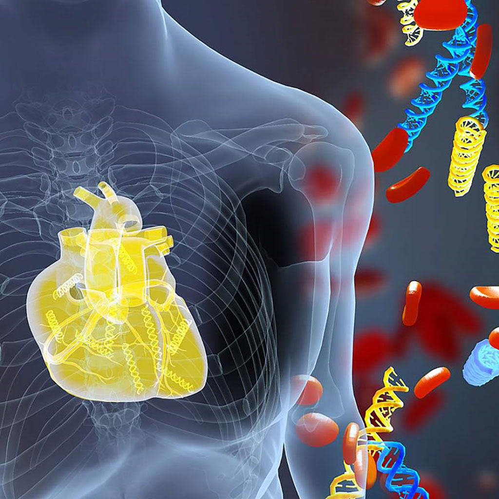 Image: DNA fragments (yellow) derived from a transplanted heart alongside the patient’s own DNA (blue). A new blood test measures donor DNA fragments and detects acute heart transplant rejection earlier than current methods (Photo courtesy of Erina He, NIH Medical Arts)
