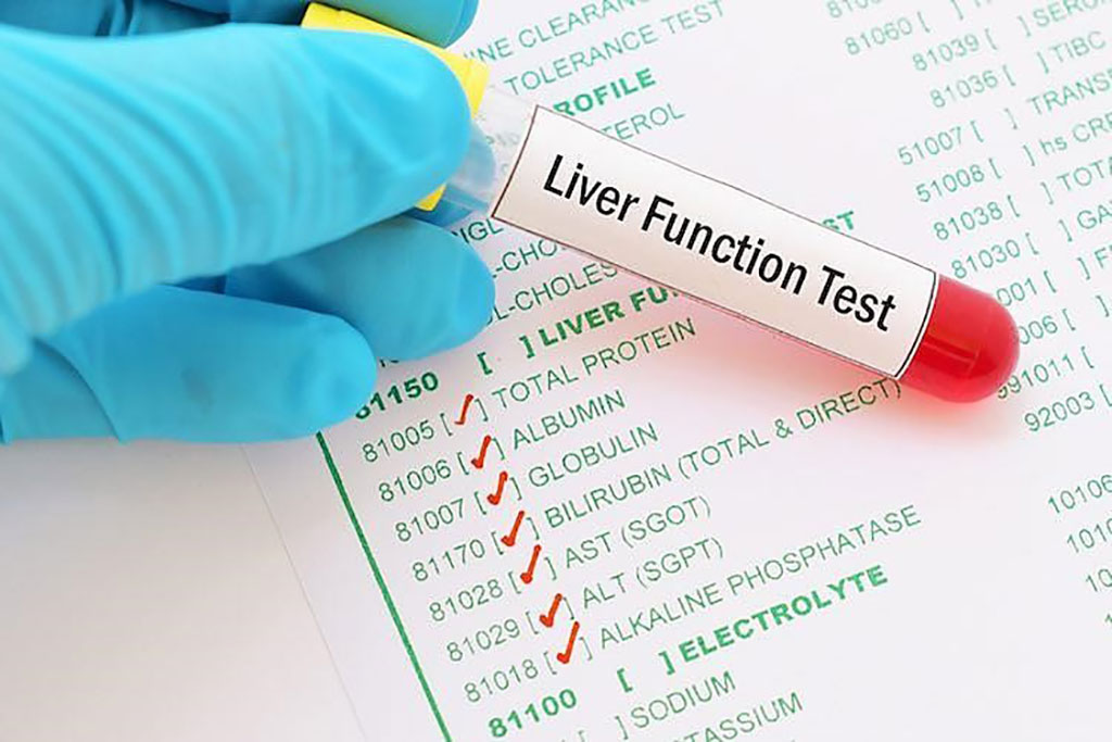 Image: Liver function test abnormalities at hospital admission are associated with severe course of SARS-CoV-2 infection (Photo courtesy of Life Line Screening).
