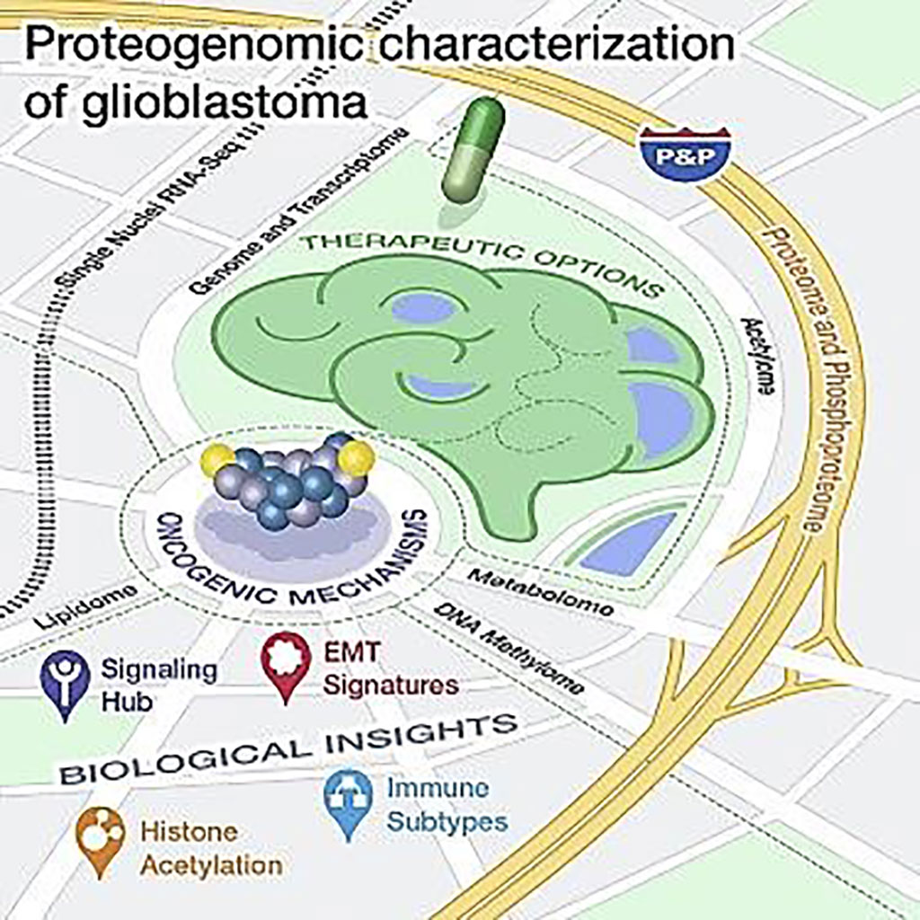 Image: Glioblastoma omics highlights informative tumor features, immune subtypes (Photo courtesy of Washington University in St. Louis).