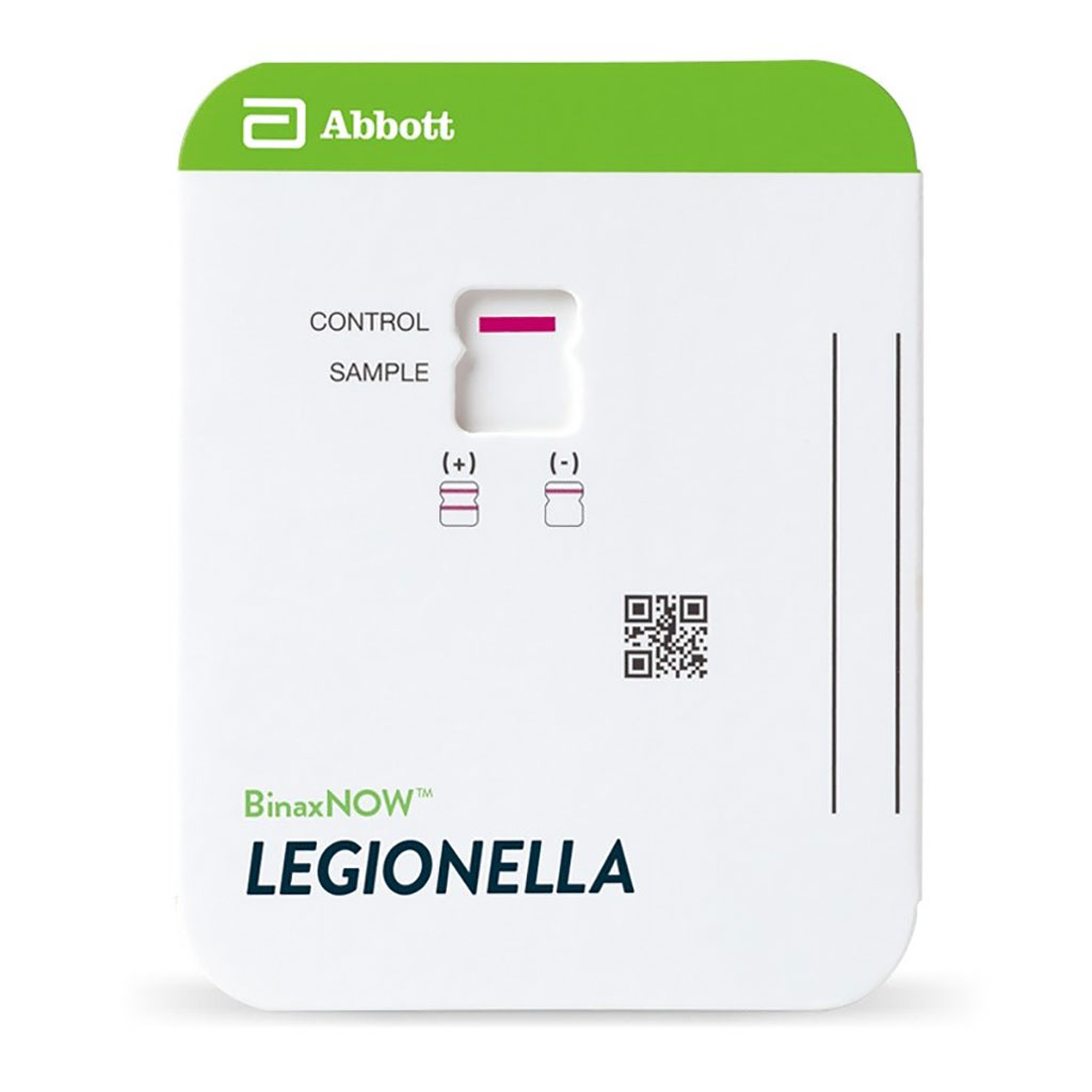 Image: The BinaxNOW Legionella Urinary Antigen Card. Accurate. Rapid identification of Legionnaires` disease caused by Legionella pneumophila serogroup 1 with an easy-to-use technology (Photo courtesy of Abbott).