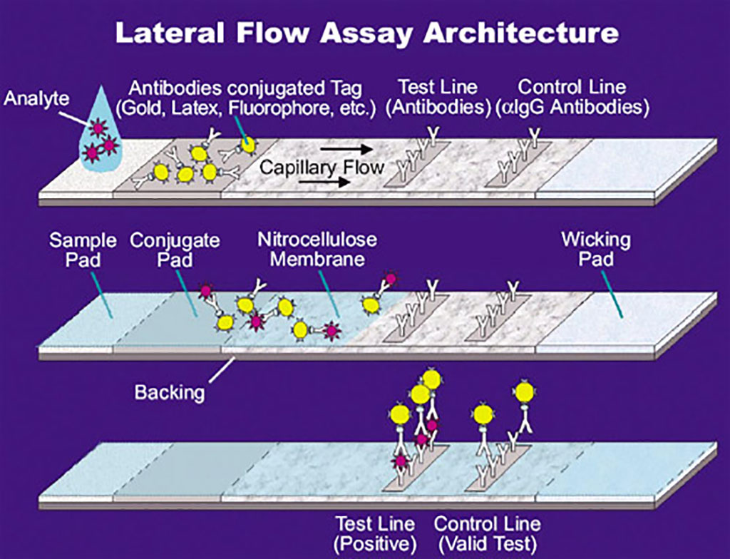 Image: Illustration of a lateral flow assay (LFA) (Photo courtesy of U.S. National Aeronautics and Space Administration via Wikimedia Commons)